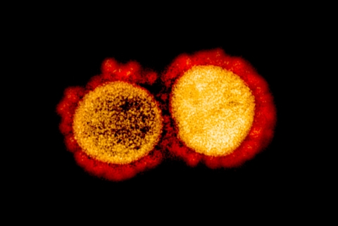 coronavirus3