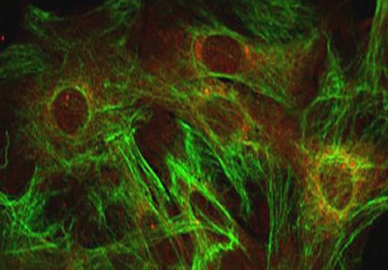 Astrocyte cells