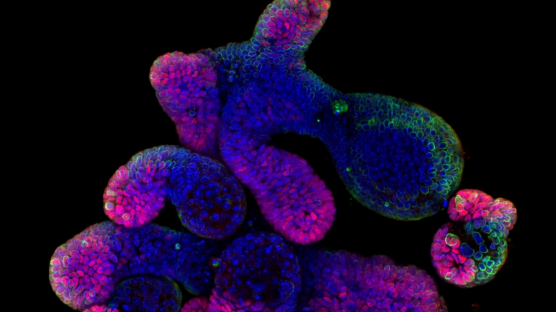 Organoides intestinals_SNSF