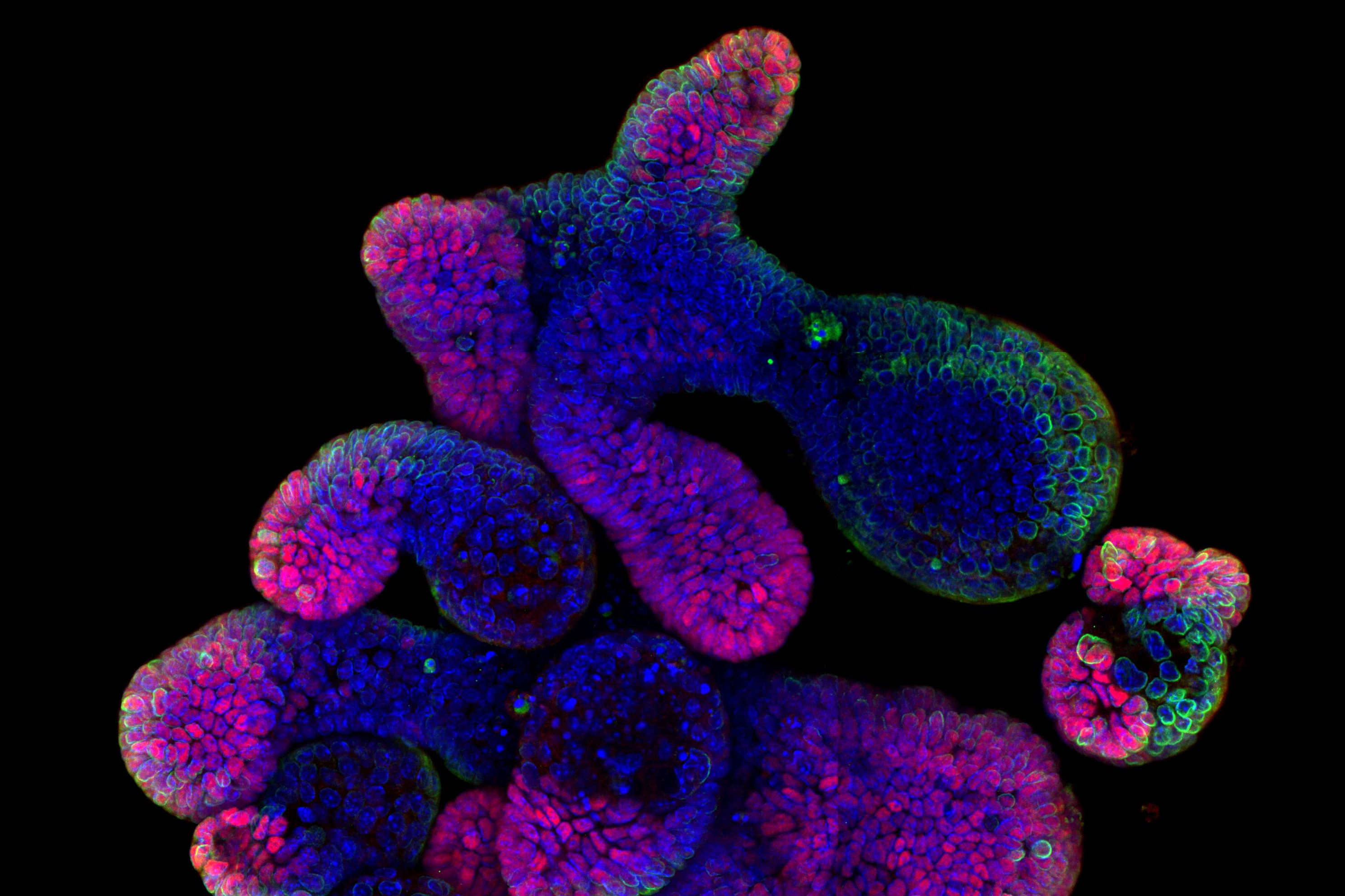 Organoides intestinals_SNSF