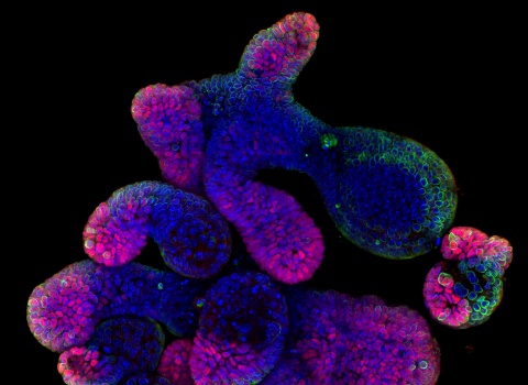 Organoides intestinals_SNSF